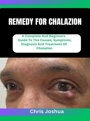 cover image of REMEDY FOR CHALAZION
